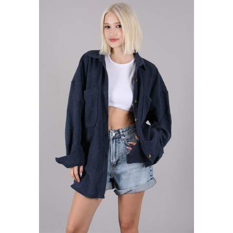 Navy Blue Oversized Overshirt MG1562 - Lacivert