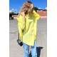 Yellow Oversize Basic Poplin Shirt MG1530 - Sarı